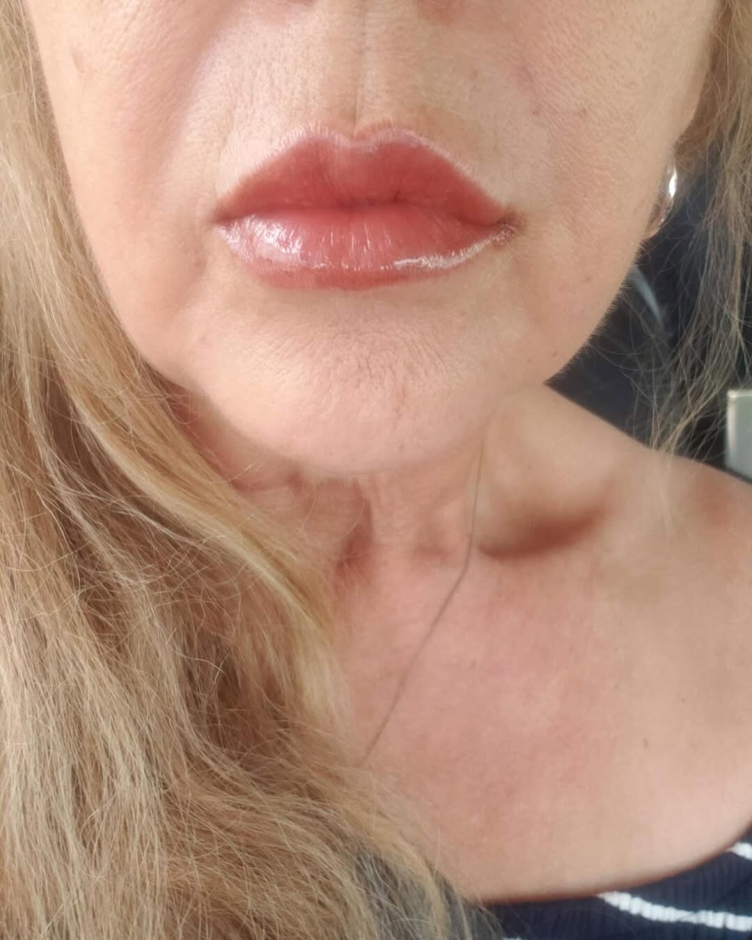 💋 Healed & Hydrated ✨Swipe to see the stunning results after healing! These lips have settled i