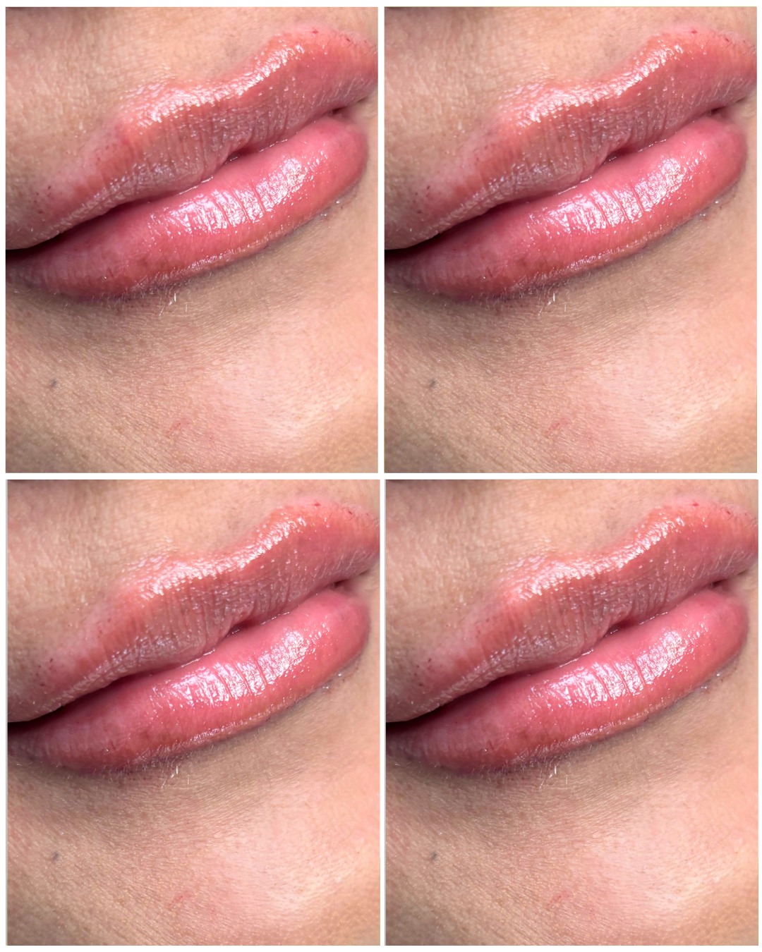 💋 Hydrated. Defined. Natural. 💋Subtle lip enhancement with a smooth, refreshed finish — becaus